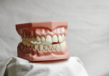 El Centre Dental Francesc Macià explica los consejos para cuidar los grills dentales