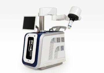 El novedoso tratamiento SONOVEIN® elimina las varices sin cirugía y sin postoperatorio