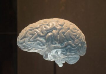 Centro Alcume trata el aumento de enfermedades neurodegenerativas y la importancia de la rehabilitación neurológica