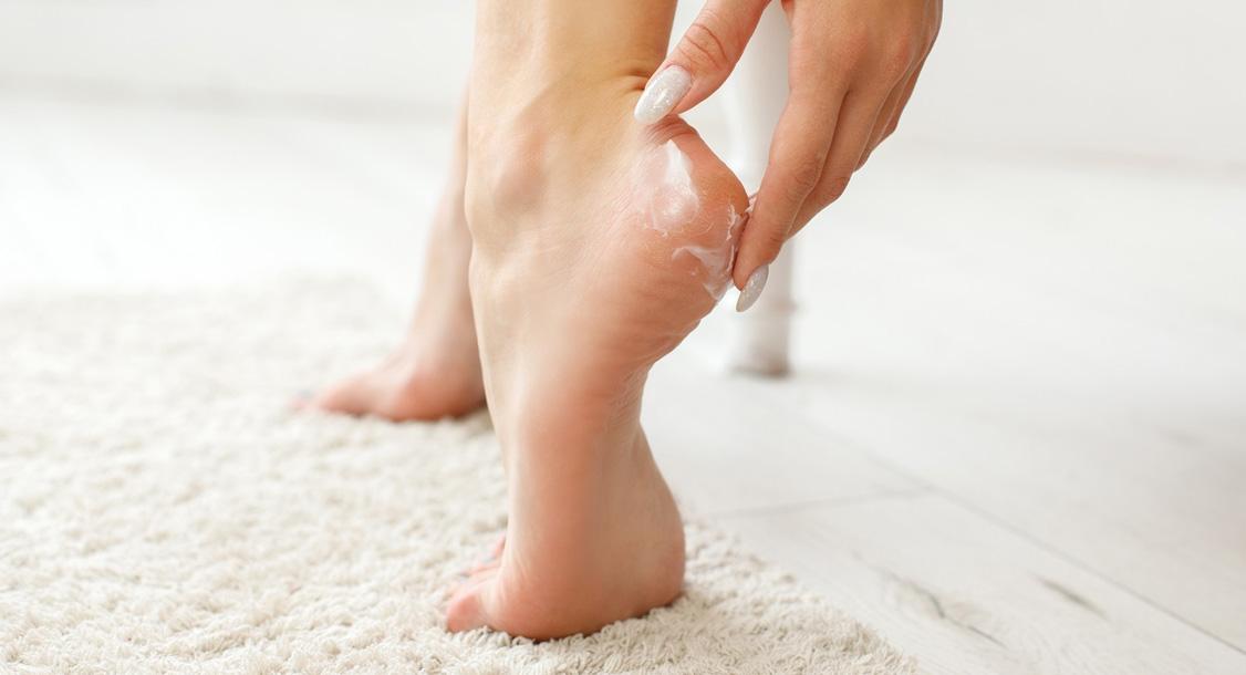 ¿Pies agrietados? Descubre cómo regenerarlos fácilmente