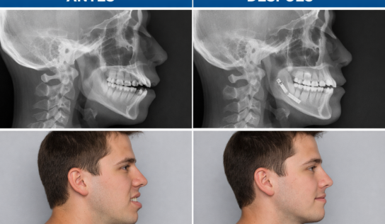 Dr. Tim Liesenhoff, cirujano maxilofacial: «Hoy los pacientes son más conscientes de la importancia de tener una mordida correcta»