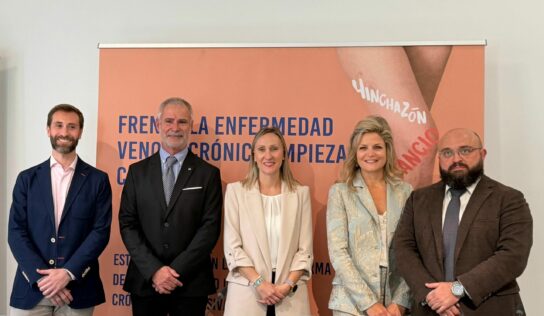Casi la mitad de la población española padece enfermedad venosa crónica