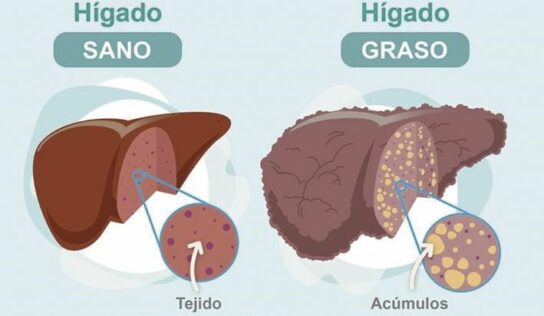 Dr. Juan Arenas, jefe servicio Aparato Digestivo:»Hoy disponemos de un nuevo medio no invasivo para detectar la fibrosis hepática»